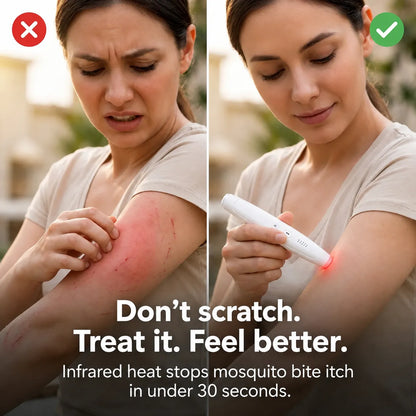 Fast Itch Relief Pen 🦟 Portable Drug-Free Heat Therapy