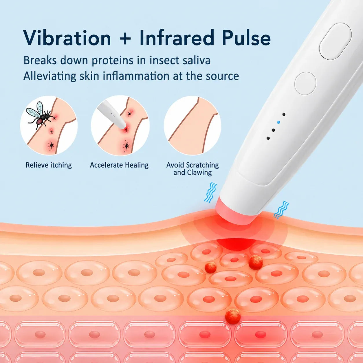 Fast Itch Relief Pen 🦟 Portable Drug-Free Heat Therapy
