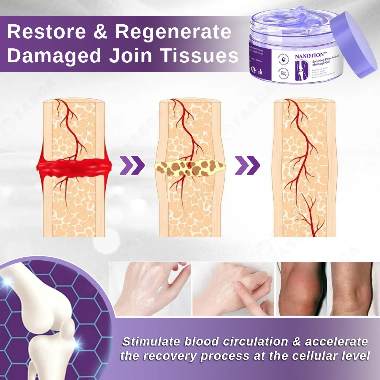 Gel Nanotion For Whole-Body Joint Pain Relief
